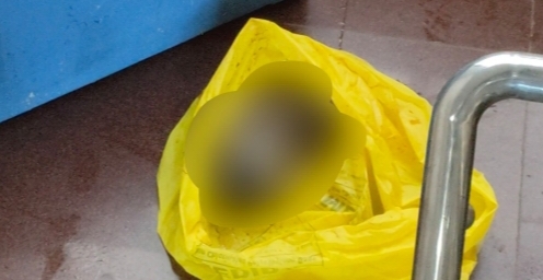 कोरबा अस्पताल के बाथरूम में मिला मानव भ्रूण, मचा हड़कंप; पुलिस और एफएसएल टीम ने शुरू की जांच
